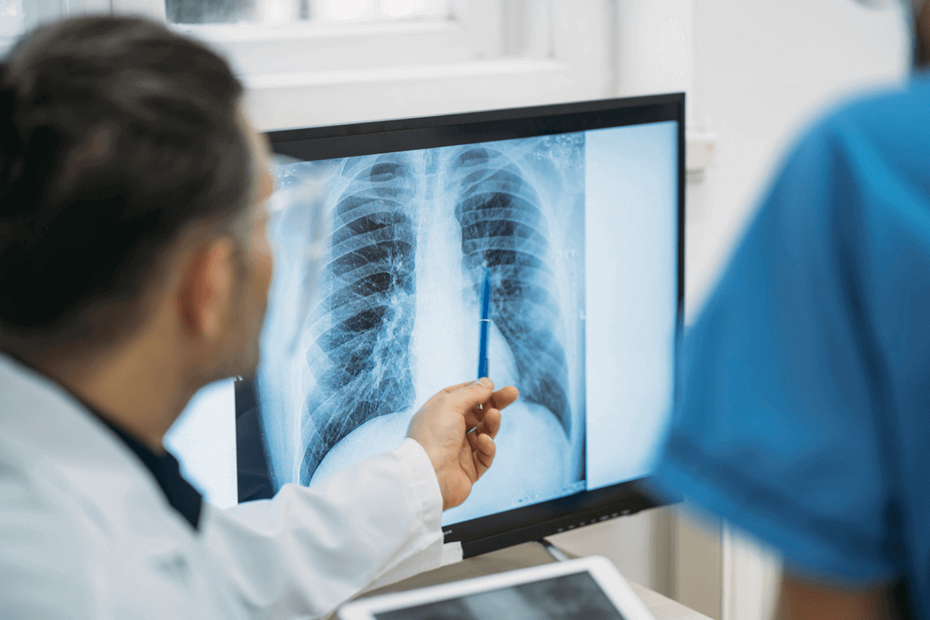 Doctor pointing at an x-ray image of a set of lungs