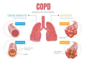 COPD Inforgraphic