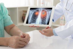 Lung Cancer Symptoms - Austin Pulmonary - Austin Texas